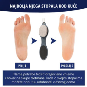 4-u-1 set za njegu stopala - SoftFeet - Image 4