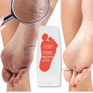 ZIAJA Obnavljajuća krema za ispucala stopala 60ml - Image 4