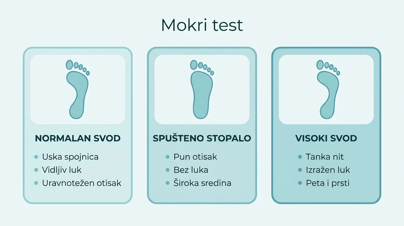 Usporedba tri mokra otiska stopala: normalan svod, spušteno stopalo i visoki svod.